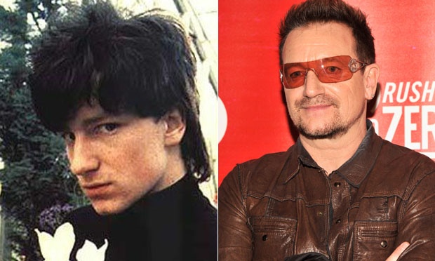 O antes e o depois dos famosos